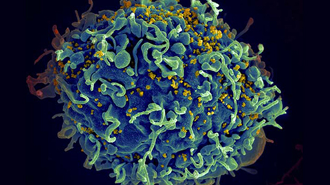 How a virus can affect memory: The role of HIV in HAND