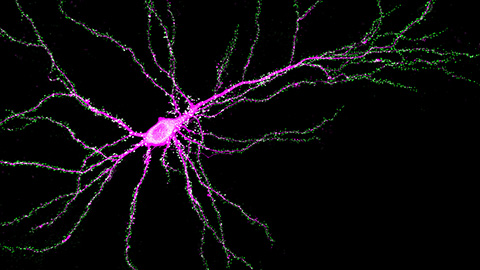 Scientists identify new function of learning and memory gene common to all mammalian brain cells