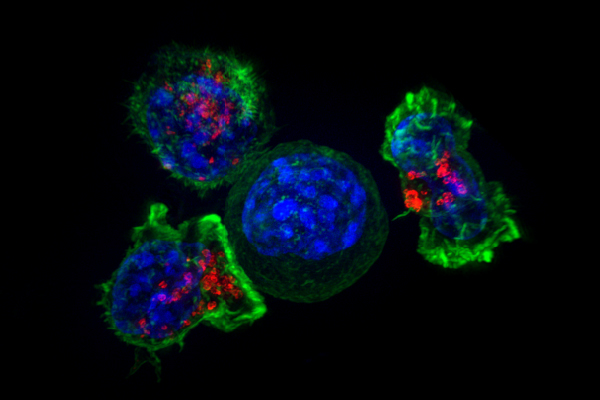 A group of killer T cells (green and red) surround a cancer cell (blue, center). When a killer T cell makes contact with a target cell, the killer cell attaches and spreads over the target, then uses special chemicals housed in vesicles (red) to deliver the killing blow. The killer T cells then move on to find the next target.