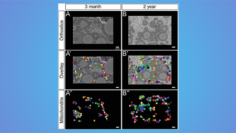 Hinton lab maps structure of mitochondria at different life stages