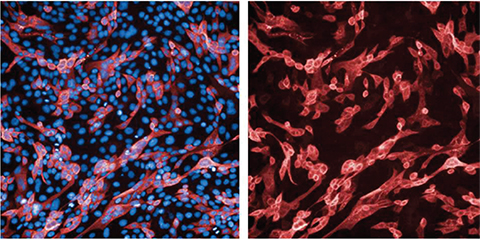 In these immunofluorescence images of lung cells 24 hours after infection with the omicron variant, (left) the blue-fluorescent stain binds DNA and indicates a cell´s nucleus and red staining binds to the SARS CoV-2 spike protein; (right) red staining of viral spike protein.