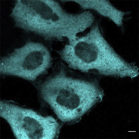 This image shows the distribution of fluorescently labelled Streptomyces sp. bacterial cholesterol oxidase in HeLa cells.