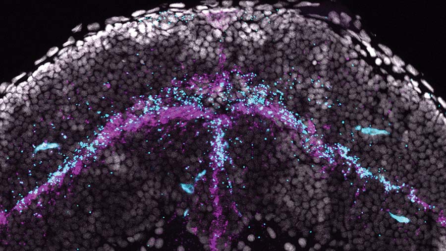 Zebrafish model links low omega-3s to eye abnormalities
