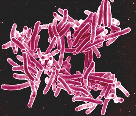 A scanning electron micrograph of Mycobacterium tuberculosis bacteria, which cause TB.
