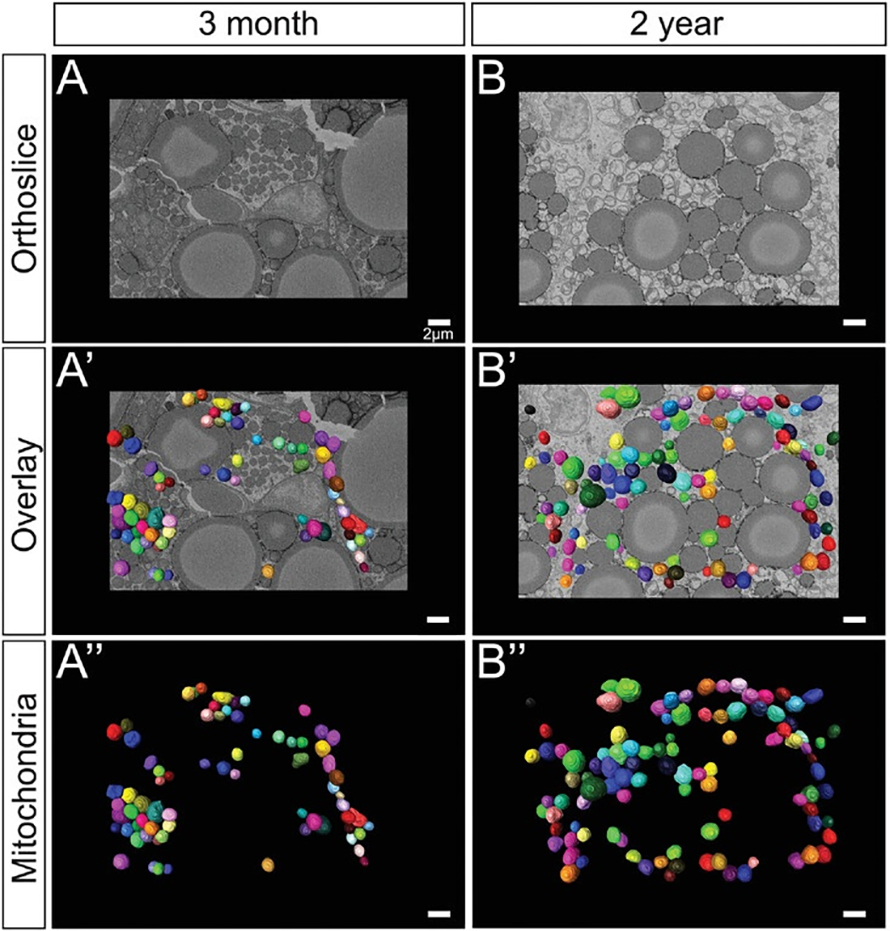 This partial figure from the paper illustrates the steps taken to compare the mitochondria of young and old mice. First, thin tissue slices were imaged with an advanced imaging method called serial block face-scanning electron microscopy. Then, the mitochondria were identified and 3D reconstructions were overlaid on the tissue images. Finally, the 3D reconstructions were analyzed for volume, surface area, and other metrics.