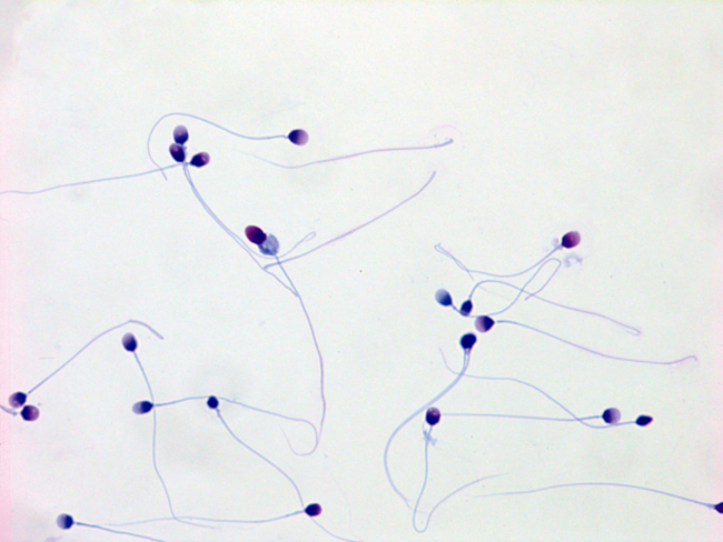 Human sperm, 1,000×