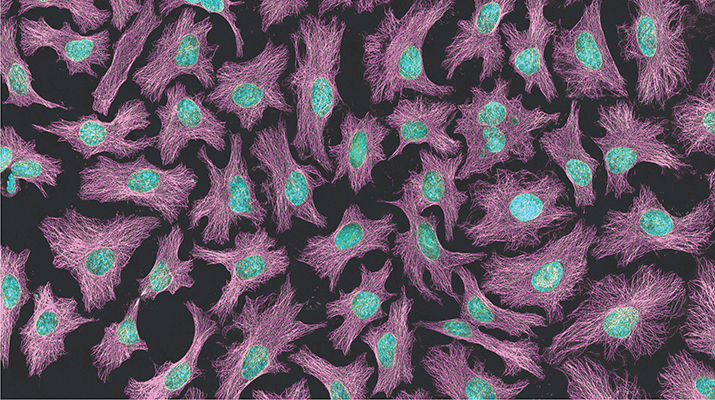 The top image, which is the same image shown on this month's cover, is a multiphoton fluorescence image of HeLa cells. Microtubules are in magenta; DNA is in cyan. Image is courtesy of Tom Derrinck at the National Center for Microscopy and Imaging Research.