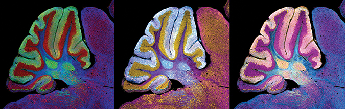 Cerebellum image