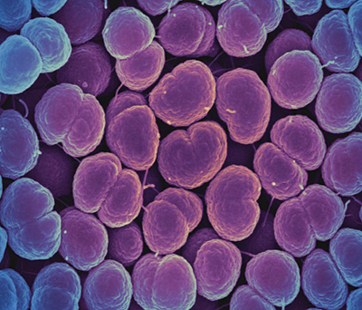 MCP: Researchers closer to gonorrhea vaccine after ...