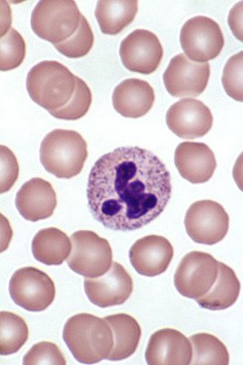 Neutrophils