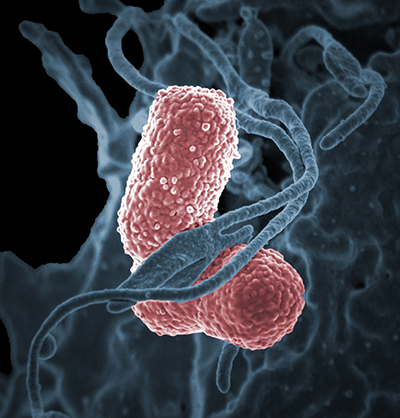 Klebsiella pneumoniae