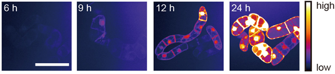 Tobacco BY-2 cells