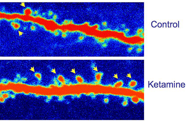 Ketamine strengthens connections between brain cells