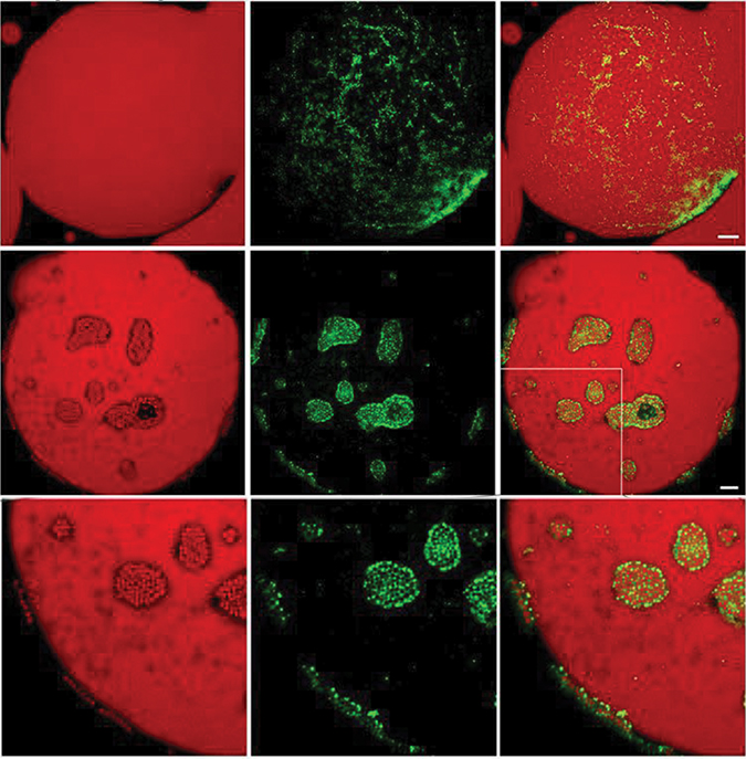 Adipocytes