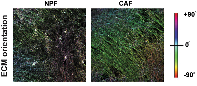 Cancer-associated fibroblasts