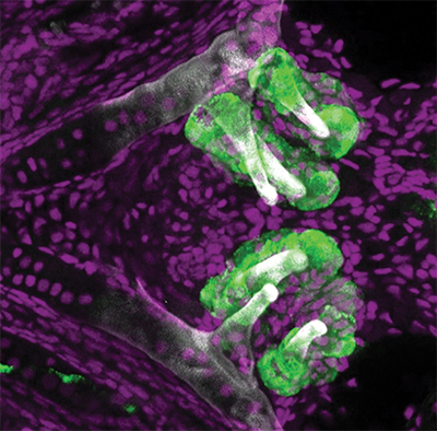 Zebrafish teeth