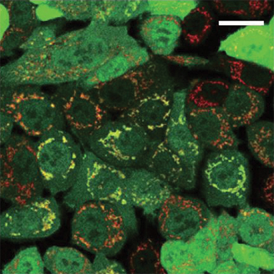 This image of cells with damaged mitochondria shows overlap This image of cells with damaged mitochondria shows overlap