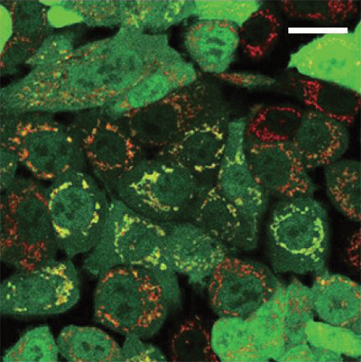 This image of cells with damaged mitochondria shows overlap