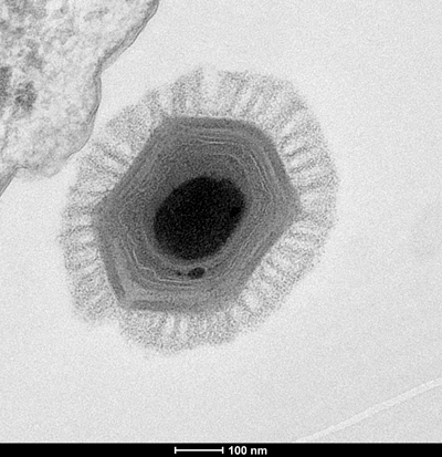 Megavirus chilensis Megavirus chilensis