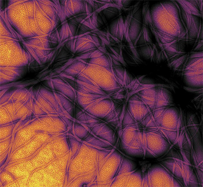 Prion protein fibrils Prion protein fibrils
