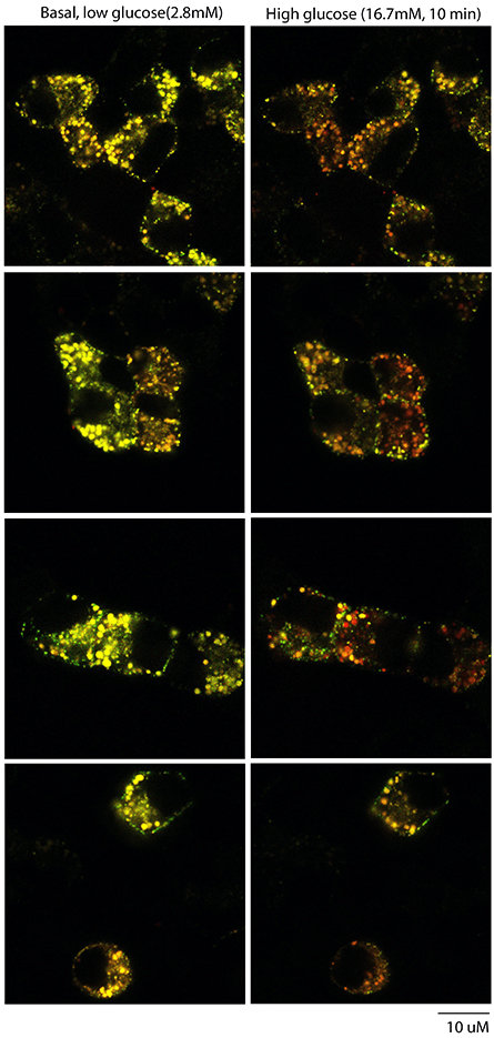 Insulin-Secretion-445x935.jpg