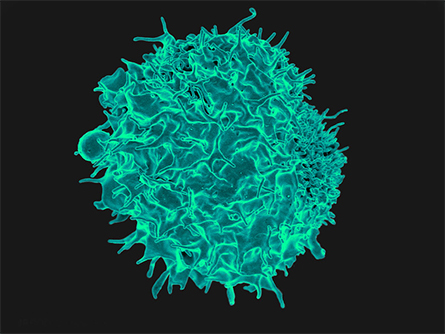 Lymphoma-445x334.jpg Lymphoma-445x334.jpg