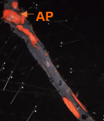 Mouse aorta with atherosclerotic lesions. Plaques are shown in red.