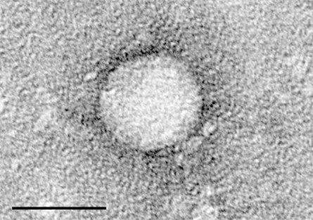 HCV_EM_picture-445x313.jpg HCV_EM_picture-445x313.jpg