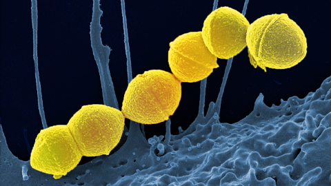 Quantifying how proteins in microbe and host interact
