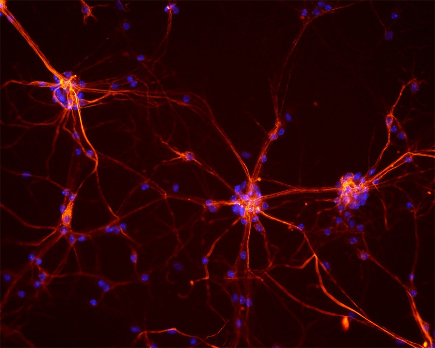 Neurons-890x712.jpg