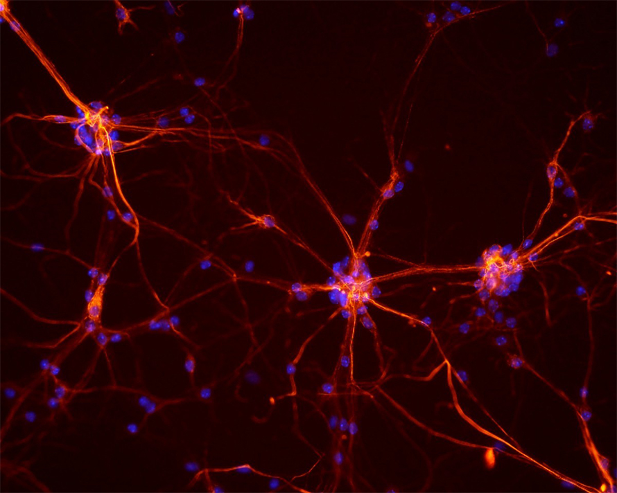 Neurons-890x712.jpg Neurons-890x712.jpg