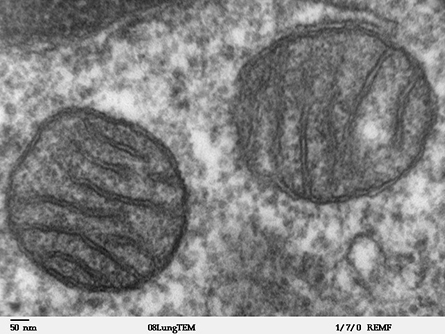 This transmission electron microscope image of a thin section cut through mammalian lung tissue shows a mitochondrion.