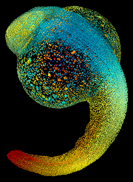 Zebrafish-Embryo-445x609.jpg Zebrafish-Embryo-445x609.jpg