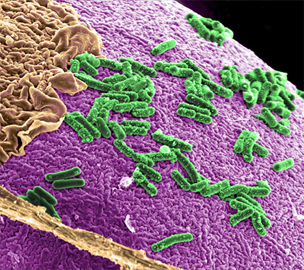 Intestinal-microbiota-445x395.jpg Intestinal-microbiota-445x395.jpg