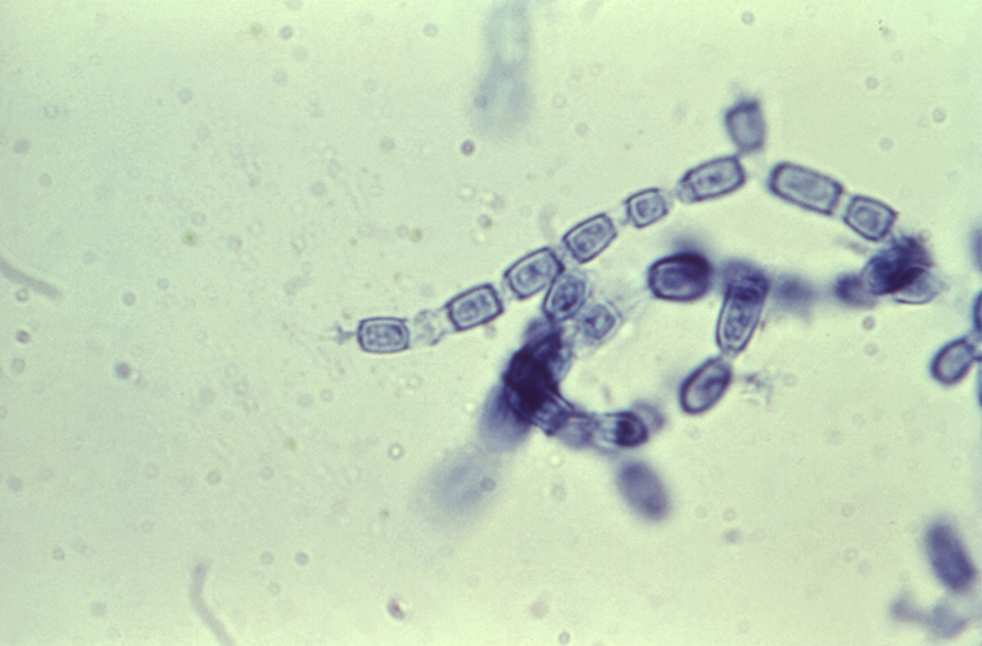 Arthrocondria-valley-fever-890x586.jpg Arthrocondria-valley-fever-890x586.jpg
