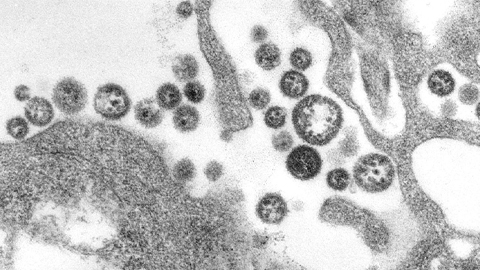 Scientists create antibody ‘cocktail’ to fight deadly Lassa virus