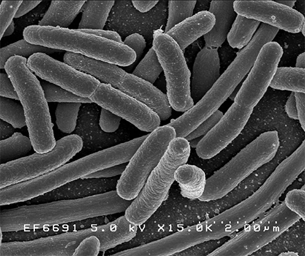 E-coli-DNA-445x374.jpg E-coli-DNA-445x374.jpg