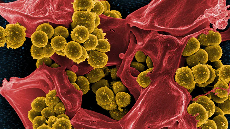 Deep learning AI discovers surprising new antibiotics