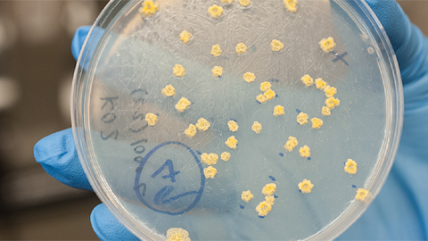 Can membrane stress protect mycobacteria?