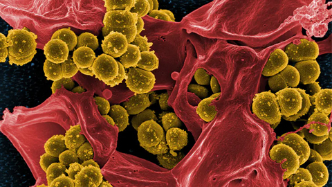 Deep learning AI discovers surprising new antibiotics
