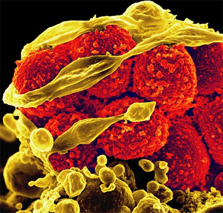 MRSA-445x425.jpg MRSA-445x425.jpg