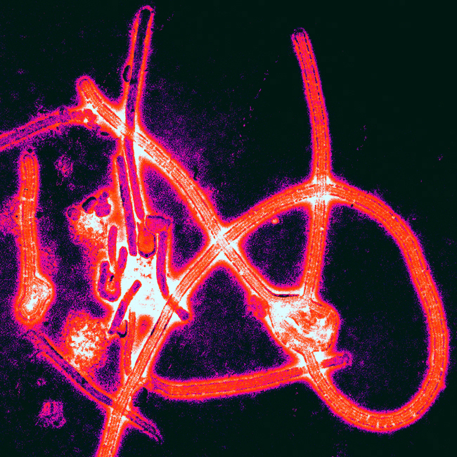 Ebola-650x650.jpg Ebola-650x650.jpg