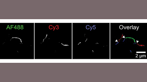 JBC: How do protein tangles get so long?