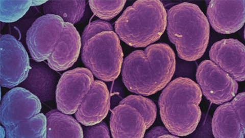 MCP: Researchers closer to gonorrhea vaccine after exhaustive analysis of proteins
