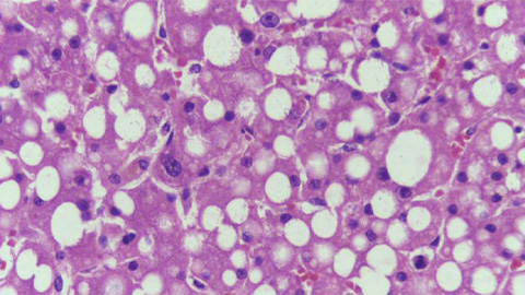 From the Journals: JLR