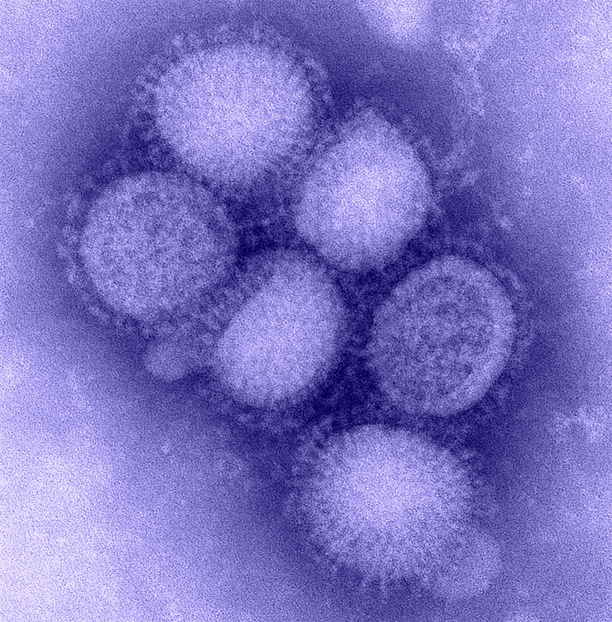 Influenza-890x904.jpg