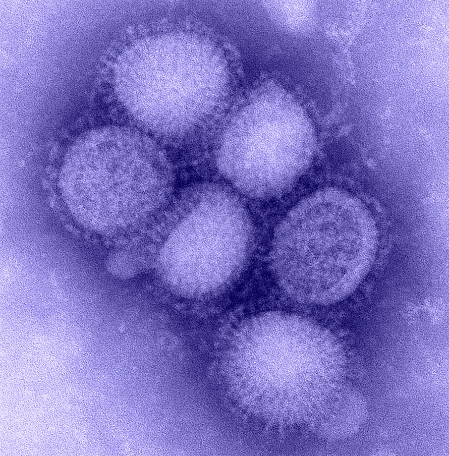 Influenza-890x904.jpg Influenza-890x904.jpg
