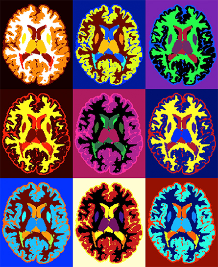 MRI-scans-445x545.jpg MRI-scans-445x545.jpg