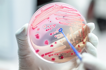 Antibiotic-resistance-445x297.jpg