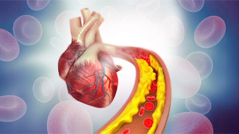 Ubiquitination by TRIM13: An ingredient contributing to diet-induced atherosclerosis